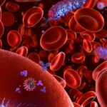 Her 5 ölümden 1’inin sebebi: Sepsis! Kan zehirlenmesi nedir?